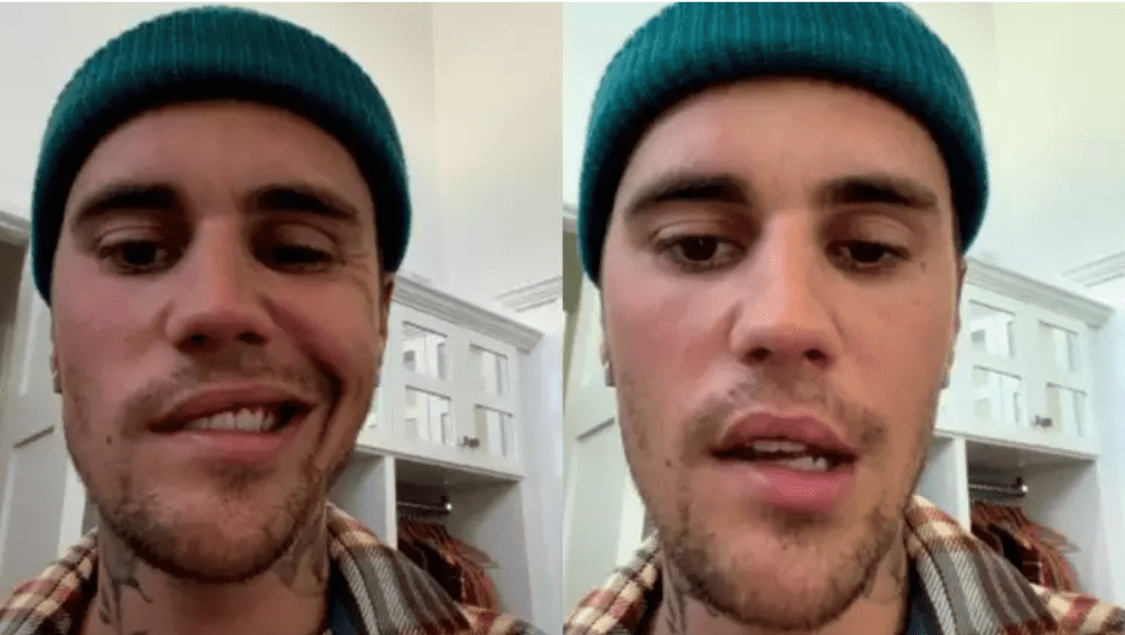 Justin Bieber grava vídeo com parte do rosto paralisado