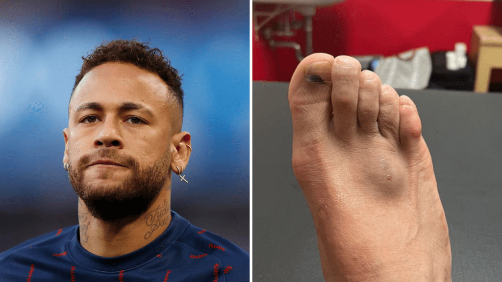 Neymar deixa treino após sofrer pisão e vira dúvida na Seleção