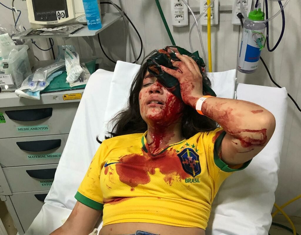 Jovem apoiadora de Bolsonaro é atacada a pedrada por petistas