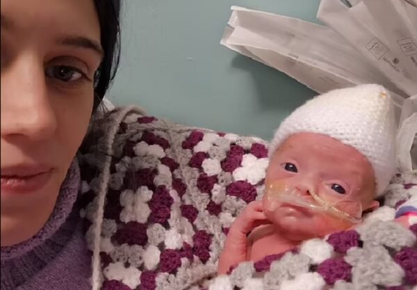 Médicos dão bebê como morto, mãe não desiste e criança revive