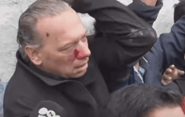 Secretário de Segurança de Buenos Aires é agredido; assista